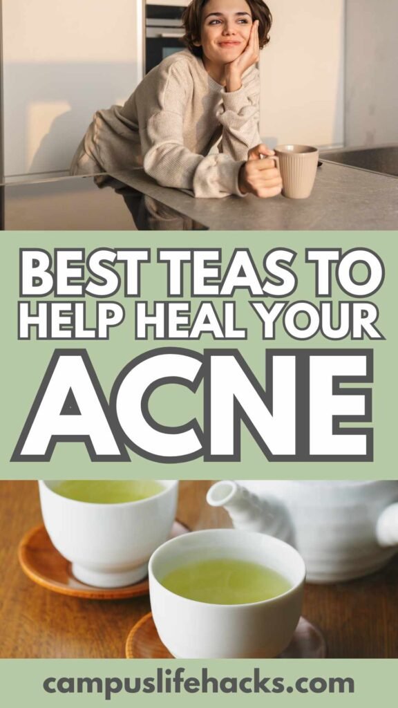 teas for acne 