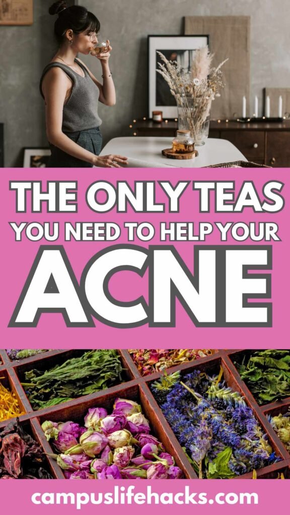 will drinking tea cure acne